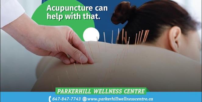 Acupuncture for Immediate back pain relief