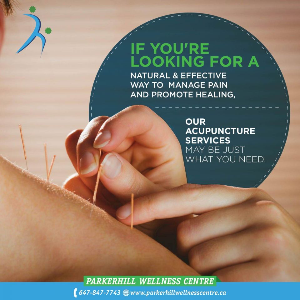 Acupuncture in Mississauga